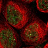 Anti-SAP18 antibody produced in rabbit Prestige Antibodies® Powered by Atlas Antibodies, affinity isolated antibody, buffered aqueous glycerol solution