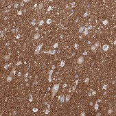 Anti-PACSIN1 antibody produced in rabbit Prestige Antibodies® Powered by Atlas Antibodies, affinity isolated antibody, buffered aqueous glycerol solution