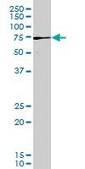 Monoclonal Anti-PAK3 antibody produced in mouse clone 3A12, purified immunoglobulin, buffered aqueous solution