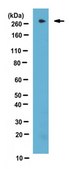 Anti-TET2 Antibody, clone hT2H 21F11 clone hT2H21F11, from mouse