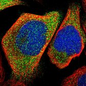 Anti-KLHDC1 antibody produced in rabbit Prestige Antibodies® Powered by Atlas Antibodies, affinity isolated antibody, buffered aqueous glycerol solution