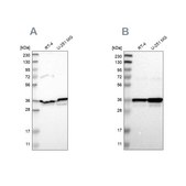 Anti-ANXA1 antibody produced in rabbit Prestige Antibodies® Powered by Atlas Antibodies, affinity isolated antibody, buffered aqueous glycerol solution