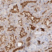 Anti-C3 antibody produced in rabbit Prestige Antibodies® Powered by Atlas Antibodies, affinity isolated antibody, buffered aqueous glycerol solution
