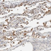 Anti-RAB11FIP1 antibody produced in rabbit Prestige Antibodies® Powered by Atlas Antibodies, affinity isolated antibody, buffered aqueous glycerol solution, Ab1