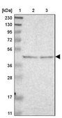 Anti-B4GALT3 antibody produced in rabbit Prestige Antibodies® Powered by Atlas Antibodies, affinity isolated antibody, buffered aqueous glycerol solution