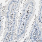 Anti-CLEC4A antibody produced in rabbit Prestige Antibodies® Powered by Atlas Antibodies, affinity isolated antibody, buffered aqueous glycerol solution