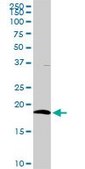 Anti-CD3D antibody produced in rabbit purified immunoglobulin, buffered aqueous solution