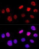 Anti-p53 antibody produced in rabbit
