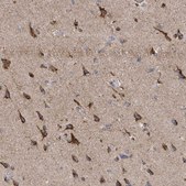 Anti-ITM2B antibody produced in rabbit Prestige Antibodies® Powered by Atlas Antibodies, affinity isolated antibody, buffered aqueous glycerol solution