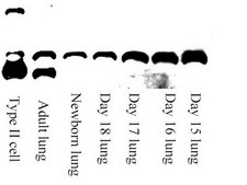 Anti-Rab40C Antibody from rabbit