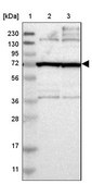 Anti-FAM161B antibody produced in rabbit Prestige Antibodies® Powered by Atlas Antibodies, affinity isolated antibody, buffered aqueous glycerol solution