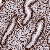 Anti-SFPQ antibody produced in rabbit Prestige Antibodies® Powered by Atlas Antibodies, affinity isolated antibody, buffered aqueous glycerol solution
