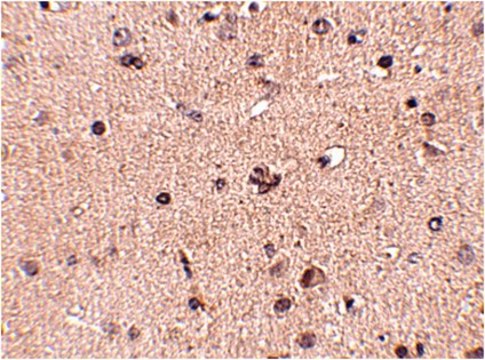 Anti-Slitrk2 Antibody from rabbit