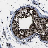 Anti-NPM1 antibody produced in rabbit Prestige Antibodies® Powered by Atlas Antibodies, affinity isolated antibody, buffered aqueous glycerol solution