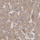 Anti-MRPL18 antibody produced in rabbit Prestige Antibodies® Powered by Atlas Antibodies, affinity isolated antibody, buffered aqueous glycerol solution, ab1