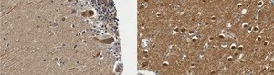 Anti-Dysbindin from rabbit, purified by affinity chromatography