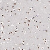 Anti-OTX2 antibody produced in rabbit Prestige Antibodies® Powered by Atlas Antibodies, affinity isolated antibody, buffered aqueous glycerol solution