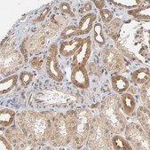 Anti-PRKAB1 antibody produced in rabbit Prestige Antibodies® Powered by Atlas Antibodies, affinity isolated antibody, buffered aqueous glycerol solution