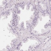 Anti-CCDC96 antibody produced in rabbit Prestige Antibodies® Powered by Atlas Antibodies, affinity isolated antibody, buffered aqueous glycerol solution