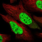 Anti-SART1 antibody produced in rabbit affinity isolated antibody, buffered aqueous glycerol solution, ab1