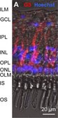 Anti-Glutamine Synthetase Antibody, clone GS-6 clone GS-6, Chemicon®, from mouse