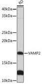 Anti-VAMP2 Antibody, clone 8X9D9, Rabbit Monoclonal