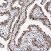 Anti-WRAP53 antibody produced in rabbit Prestige Antibodies® Powered by Atlas Antibodies, affinity isolated antibody, buffered aqueous glycerol solution