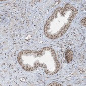 Anti-DBR1 antibody produced in rabbit Prestige Antibodies® Powered by Atlas Antibodies, affinity isolated antibody, buffered aqueous glycerol solution