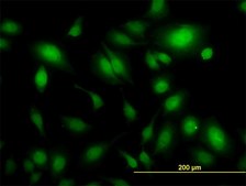 Monoclonal Anti-USP34 antibody produced in mouse clone 2E2, purified immunoglobulin, buffered aqueous solution
