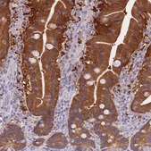 Anti-DHRS11 antibody produced in rabbit Prestige Antibodies® Powered by Atlas Antibodies, affinity isolated antibody, buffered aqueous glycerol solution