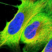 Anti-RASAL1 antibody produced in rabbit Prestige Antibodies® Powered by Atlas Antibodies, affinity isolated antibody, buffered aqueous glycerol solution