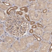 Anti-BRAF antibody produced in rabbit Prestige Antibodies® Powered by Atlas Antibodies, affinity isolated antibody, buffered aqueous glycerol solution