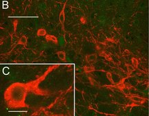 Anti-CAR Antibody, clone RmcB clone RmcB, Upstate®, from mouse