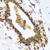 Anti-RAIDD/CRADD Antibody, clone 7M7M6, Rabbit Monoclonal