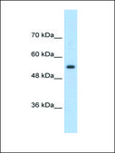 Anti-SLC13A3 (AB2) antibody produced in rabbit IgG fraction of antiserum