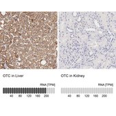Anti-OTC antibody produced in rabbit Prestige Antibodies® Powered by Atlas Antibodies, affinity isolated antibody, buffered aqueous glycerol solution