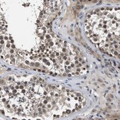 Anti-ZBTB46 antibody produced in rabbit Prestige Antibodies® Powered by Atlas Antibodies, affinity isolated antibody, buffered aqueous glycerol solution