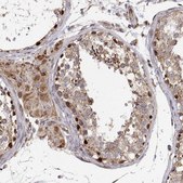 Anti-SPICE1 antibody produced in rabbit Prestige Antibodies® Powered by Atlas Antibodies, affinity isolated antibody, buffered aqueous glycerol solution