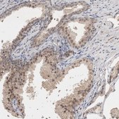 Anti-HUS1 antibody produced in rabbit Prestige Antibodies® Powered by Atlas Antibodies, affinity isolated antibody, buffered aqueous glycerol solution