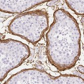 Anti-FBN1 antibody produced in rabbit Prestige Antibodies® Powered by Atlas Antibodies, affinity isolated antibody, buffered aqueous glycerol solution