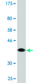 Monoclonal Anti-RABGAP1L antibody produced in mouse clone 2D3, purified immunoglobulin, buffered aqueous solution