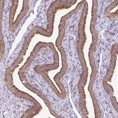 Anti-RPL28 antibody produced in rabbit Prestige Antibodies® Powered by Atlas Antibodies, affinity isolated antibody, buffered aqueous glycerol solution
