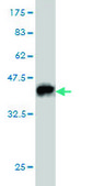 Monoclonal Anti-RPS6KA6 antibody produced in mouse clone 6F2, purified immunoglobulin, buffered aqueous solution