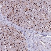 Anti-THOC2 antibody produced in rabbit Prestige Antibodies® Powered by Atlas Antibodies, affinity isolated antibody, buffered aqueous glycerol solution