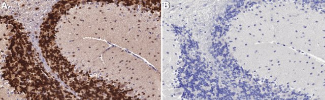 Anti-NeuN Antibody (rabbit) from rabbit, purified by affinity chromatography