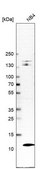 Anti-LSM2 antibody produced in rabbit Prestige Antibodies® Powered by Atlas Antibodies, affinity isolated antibody, buffered aqueous glycerol solution