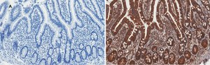 Anti-AMPK alpha Antibody, clone 2D22, ZooMAb® Rabbit Monoclonal recombinant, expressed in HEK 293 cells