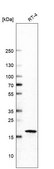 Anti-CDKN1A antibody produced in mouse Prestige Antibodies® Powered by Atlas Antibodies, clone CL13081, purified by using Protein A, buffered aqueous glycerol solution