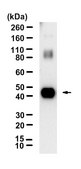 Anti-TGF β receptor 1 Antibody, clone 4H18 ZooMAb® Rabbit Monoclonal recombinant, expressed in HEK 293 cells