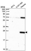 Anti-CLEC7A antibody produced in rabbit Prestige Antibodies® Powered by Atlas Antibodies, affinity isolated antibody